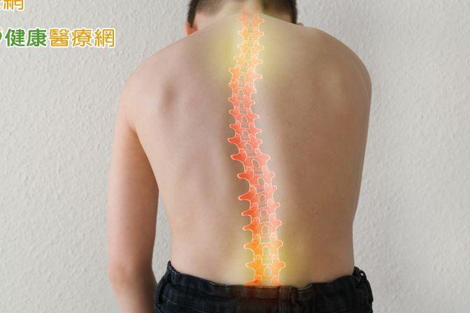 How does Chinese medicine treat scoliosis? A three-dimensional approach of acupuncture, medication and rehabilitation